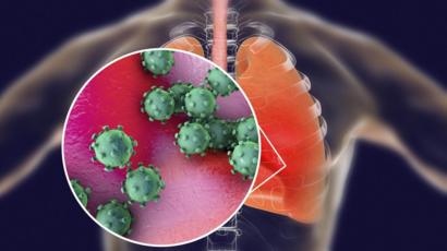 coronavirus-in-lungs